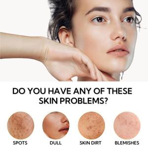 OEM lussuose saponette arricchite con sapone al litchi al burro di karité per uomini, donne e tutti i tipi di pelle (14 barrette/mazzo) - Product Image 5