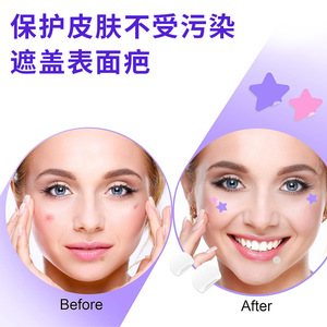 Patchs anti-acné colorés en forme de cœur, fins et respirants, pour peaux grasses et mixtes - Product Image 3