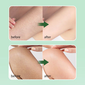 OEM Huile essentielle de jasmin biologique Anti-rides, huile SPA hydratante et nourrissante pour l'entretien et la réparation de la peau - Product Image 2