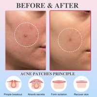 Patch anti-acné hydrocolloïde personnalisé avec logo, points colorés, patch facial étoile pour les boutons, beauté et soins personnels
