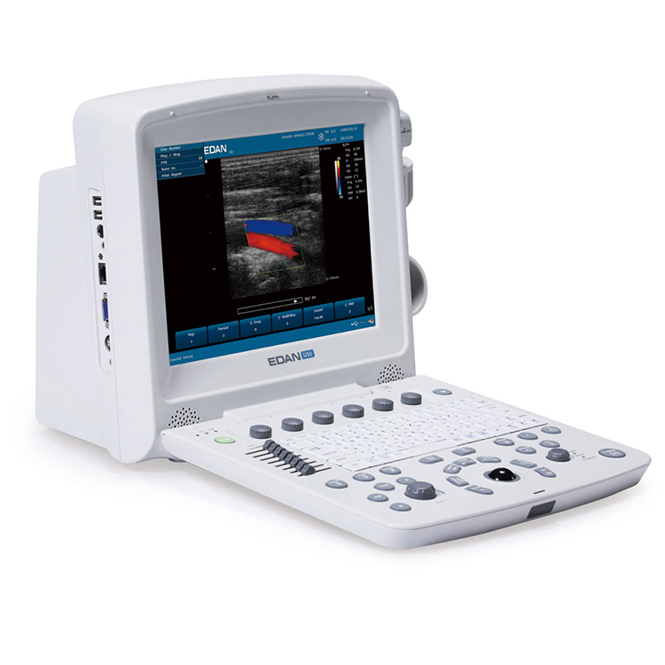 Sistema de diagnóstico de diagnóstico de Fábrica Edan U50 color gotero médico ultrasonido