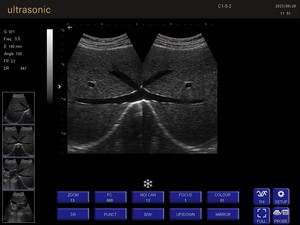 Ecógrafo Portátil para Mascotas, Perros y Gatos, KT-A028 - Product Image 3