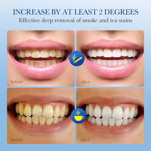 Vente en gros de dentifrice 100g, élimine les taches de fumée, dentifrice blanchissant, nettoie les dents et les gencives, pâte dentifrice, dentifrice - Product Image 4