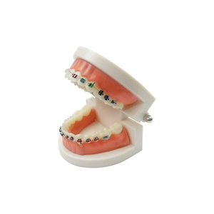 Modelo Anatómico de Ortodoncia con Autobloqueo 1/4, Soportes de Resina Plástica PVC, Modelos Dentales MX-070, Educación y Enseñanza al Paciente - Product Image 1