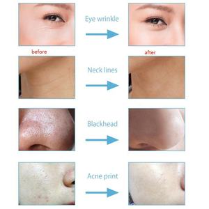 2023z 3-in-1 Diamant Microdermabrasie Apparaat Vacuüm Zuigapparaat Water Spray Gezichtsbehandeling Hydraterende Gezichtsreiniging Huid Exfoliatie Huidpeeling - Product Image 6