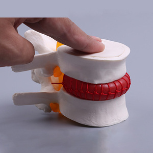 Đĩa Đệm Thắt Lưng Người Mô Hình Bệnh Lý Thoát Vị Mô Hình Đĩa Đệm - Product Image 6