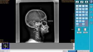 Sistema DR X Ray Medial Radiología Digital Flat Panel Wired Xray - Product Image 5