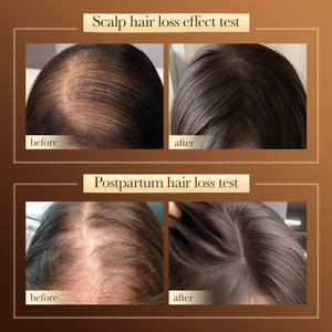 Productos para el Cuidado del Cabello al por Mayor OEM SADOER, Champú Natural Orgánico de Hoja de Ciprés y Queratina para el Crecimiento del Cabello y la Caída del Cabello para Hombres y Mujeres - Product Image 6