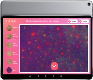 Analizador de cuero cabelludo todo en uno con sistema de informes múltiples <span class=keywords><strong>Compatible</strong></span> con Android <span class=keywords><strong>IOS</strong></span> - Product Image 5