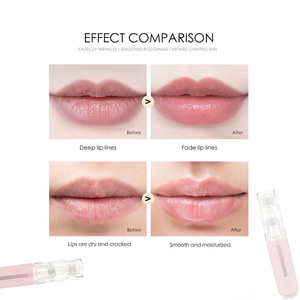 Benutzer definiertes Logo Heimgebrauch <span class=keywords><strong>Mini</strong></span> Skin Lip Hydra Face Roller Lippen füller Plumper Lip Booster 0,5mm 0,25mm 1mm für Dark Dry - Product Image 6