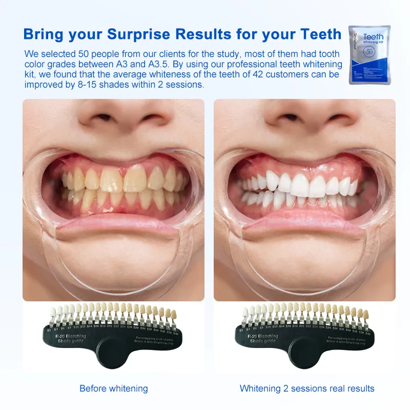 Salon văn phòng nha khoa blanchiment răng trắng răng làm trắng Gel chuyên nghiệp hydrogen peroxide 35% răng làm trắng Bộ dụng cụ