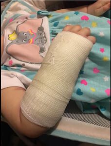 Échantillon gratuit Élimination orthopédique Chirurgie respirante en fibre de verre <span class=keywords><strong>Plâtre</strong></span> de Paris Ruban - Product Image 4