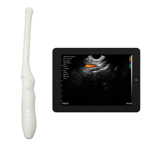 Escáner <span class=keywords><strong>de</strong></span> Ultrasonido Doppler Transvaginal Inalámbrico CProbe-4T, 96 Elementos, 32 Canales, para Examen <span class=keywords><strong>Vaginal</strong></span> - Product Image 4