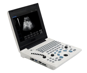 Échographe numérique complet de haute qualité et très demandé pour usage vétérinaire et scanner d'échographie de haute qualité pour vétérinaires - Product Image 2