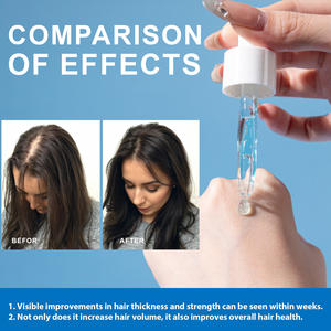 Укрепляет корни волос/кожу головы 30 мл питательное увлажняющее медное пептидное масло сыворотки волос с медным Tripeptide-1 - Product Image 6