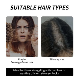 Champú de Aceite de Ricino y Romero al por Mayor, Champú Activador de Raíces para el Crecimiento del Cabello, Champú Anticaída - Product Image 5