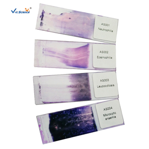 Disturbances in Human Blood Circulation Pathological <strong>Microscope</strong> Prepared Slides Histology Medical Science Prepared Slides - Product Image 3