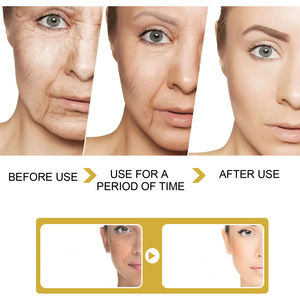 2025 nueva llegada Etiqueta Privada piel arrugas aligeramiento blanqueamiento cara crema eliminadora de arrugas - Product Image 5