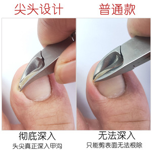 Vente en gros de coupe-cuticules en acier inoxydable, outils pour nail art, coupe-ongles pour cuticules, coupe-ongles pour ongles incarnés, dissolvants de cuticules - Product Image 4