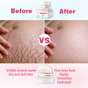 Crème <span class=keywords><strong>anti</strong></span>-vergetures pour la <span class=keywords><strong>grossesse</strong></span> et la prise de poids, atténue les cicatrices, raffermit et nourrit, hydratant corporel pour femmes - Product Image 3