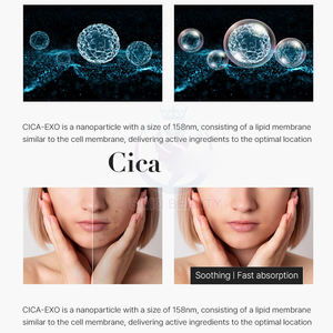 Solution <span class=keywords><strong>anti</strong></span>-rides Sérum <span class=keywords><strong>anti</strong></span>-<span class=keywords><strong>stress</strong></span> PDRN pour soigner les cicatrices d'acné - Product Image 3