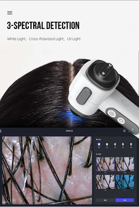 Portátil Ai cuero cabelludo UV piel análisis de <span class=keywords><strong>cabello</strong></span> espejo de belleza inteligente Trichocamera Wifi prueba de folículo piloso análisis de cuero cabelludo - Product Image 5