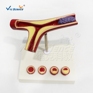 Modelo cardiovascular humano, modelo de trombosis patológica - Product Image 4