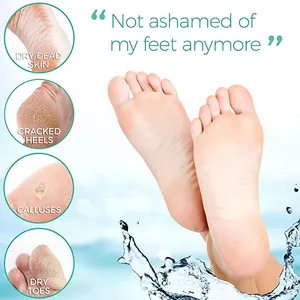 Personal Body Care For Foot Skin Smooth Whitening Make Your Feet Baby Soft Foot Exfoliating Peeling Mask