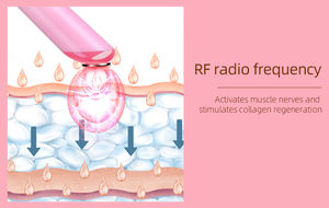 Le masseur oculaire électrique avec le dispositif de beauté de chauffage enlèvent la ride d'oeil sous la <span class=keywords><strong>machine</strong></span> de traitement de sac d'oeil - Product Image 4
