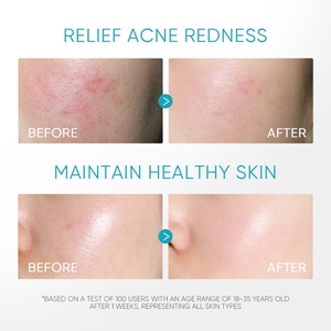 Hydratant pour le visage Apaisant <span class=keywords><strong>Anti</strong></span> Rougeurs 5% Panthénol Acné Calmant Gel D'eau Visage Crème De <span class=keywords><strong>Jour</strong></span> Et De Nuit - Product Image 5