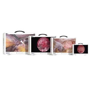 กล้องเอนโดสโคป Camjoy Full HD ขนาด 15.6/<span class=keywords><strong>22</strong></span>/24/27 นิ้ว สำหรับใช้ทางการแพทย์ ความละเอียดสูง ใช้งานร่วมกับกล้องแบบแข็งได้ - Product Image 2