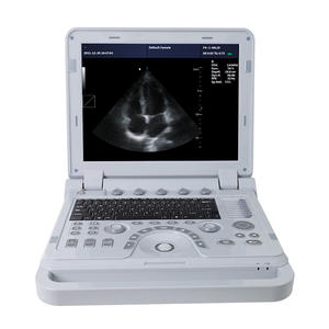 Doppler Foetale Hartdetectie Laptop-stijl Hoge Resolutie Realtime Beeldvorming voor Veehouderij Veterinaire Echografie Apparaat - Product Image 1