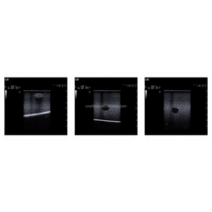 แบบจำลองการเจาะด้วยอัลตราซาวด์สำหรับการฝึกอบรมการรักษาด้วยอัลตราซาวด์บริเวณเต้านม พร้อมเนื้องอกโปร่งใส - Product Image 2