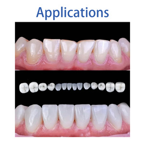 LEONGY Blocs dentaires entièrement en céramique approuvés CE, norme CAD <span class=keywords><strong>pour</strong></span> applications dentaires, facettes dentaires, 5 pièces/boîte - Product Image 3