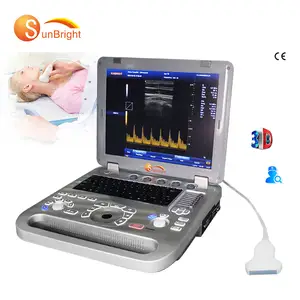 new developed economic Portable 3D function 15" color images PW Doppler diagnostic ultrasound promotion