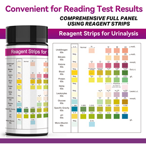 Bandelettes de test <span class=keywords><strong>urinaire</strong></span> à <span class=keywords><strong>11</strong></span> <span class=keywords><strong>paramètres</strong></span>, homologuées CE ISO, de fabrication chinoise, pour instruments d'analyse clinique et systèmes d'analyse <span class=keywords><strong>urinaire</strong></span> - Product Image 2