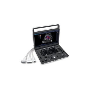 Sonoscape E1expv, Mejor Precio, Ecógrafo Doppler Color Portátil de Alta Calidad, Máquina de Ultrasonido Doppler Color para Veterinaria - Product Image 1