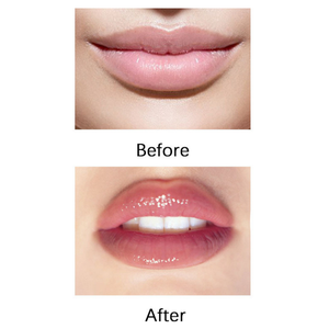 Productos de Moda, Mejor Voluminizador de <span class=keywords><strong>Labios</strong></span>, Dispositivo Voluminizador de <span class=keywords><strong>Labios</strong></span>, Voluminizador de <span class=keywords><strong>Labios</strong></span> con Colágeno - Product Image 4