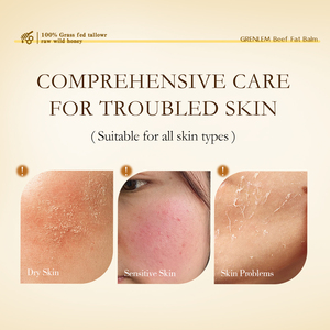 Baume au suif de bœuf marque privée <span class=keywords><strong>pour</strong></span> l'eczéma, le <span class=keywords><strong>psoriasis</strong></span>, la peau sèche – Hydratant naturel réparateur <span class=keywords><strong>pour</strong></span> le visage et le corps à la cire <span class=keywords><strong>d</strong></span>'abeille et à l'<span class=keywords><strong>huile</strong></span> <span class=keywords><strong>d</strong></span>'<span class=keywords><strong>olive</strong></span> - Product Image 4