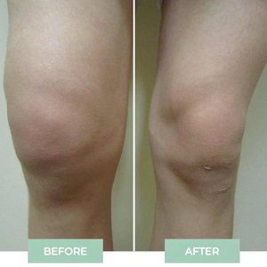 Solución de Problemas 2025 Nuevo Producto de Masaje 2025 Producto de Tendencia 2025 Recién Llegado Máquina de Masaje Corporal para Rodillas y Cama Fisioterapia - Product Image 6