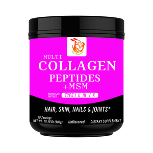 Poudre de collagène personnalisée en usine pour soutenir la flexibilité des articulations, supplément protéiné, boisson au collagène, boisson vitaminée pour femmes - Product Image 1
