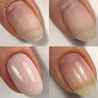 KODIES GEL – Base Coat en Caoutchouc Fibreux SOS avec Logo Personnalisé, Vernis Gel UV Non Toxique pour Réparation des Ongles, Gel Constructeur Fin et Souple pour Ongles