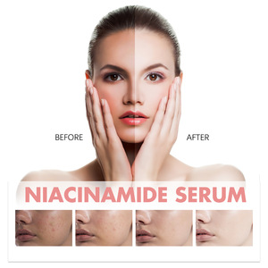 Suero facial de melocotón de alta calidad, blanqueamiento, brillo, hidratante, 30ml, suero antiarrugas de niacinamida de melocotón - Product Image 4