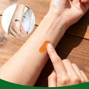 Crème anti-moustiques et anti-piqûres d'insectes à base de plantes pour soulager les démangeaisons de la peau lors des sorties et des voyages - Product Image 2