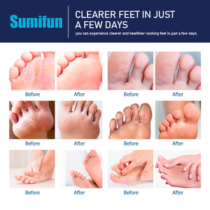Déodorant pour les pieds Spray Chaussures Désodorisant <span class=keywords><strong>Anti</strong></span>-fissuration Supprimer les bactéries <span class=keywords><strong>Odeur</strong></span> particulière Pieds Déodorant Crème pour les pieds Brume Ensemble - Product Image 6