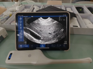 Ecógrafo Veterinario Portátil DMU92, Ginecología/Endovaginal, Wifi, Inalámbrico, Escáner Transvaginal para Humanos/Veterinarios - Product Image 2