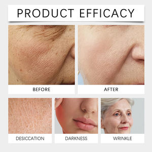 Crema de Proteína Natural con Ceramida y Leontopodium Alpinum, Calma el Enrojecimiento, Ligera, Sin Aceite, 50g, para Piel Mixta, Rutina Diaria - Product Image 3