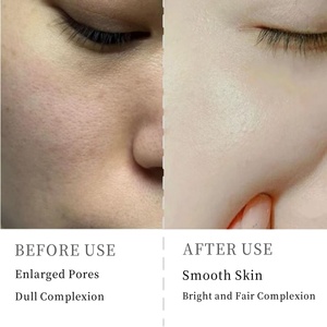Huyết thanh nghệ với Niacinamide thay thế rạng rỡ tăng cường huyết thanh trên khuôn mặt cải thiện kết cấu da tinh chỉnh sự xuất hiện lỗ chân lông - Product Image 6