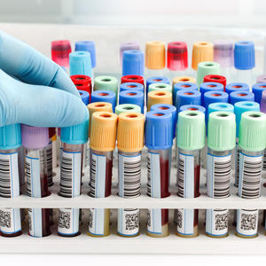 혈액 검사 튜브 용 자체 접착 맞춤형 사전 인쇄 광택 PP 방수 비닐 일련 번호 바코드 QR 코드 스티커 라벨 - Product Image 3