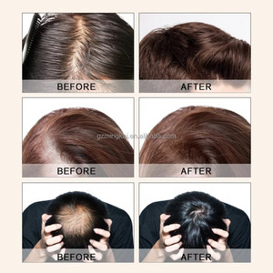 Shampo dan Kondisioner Perawatan Anti Rontok Rambut Profesional IVS Label Pribadi Grosir Pabrik OEM untuk Pertumbuhan Rambut - Product Image 2